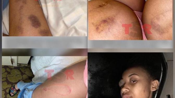 Man beats woman pregnant with his child, has beaten her multiple times, still isn’t in jail. Why do men abuse women they’re in relationships with?