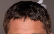 Most attractive hairstyle for big forehead/receding hairline?