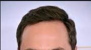 Most attractive hairstyle for big forehead/receding hairline?