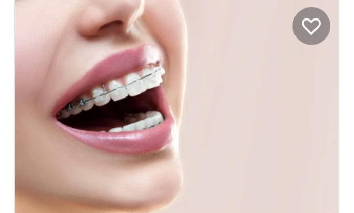 Are a lot of people self conscious about their teeth?