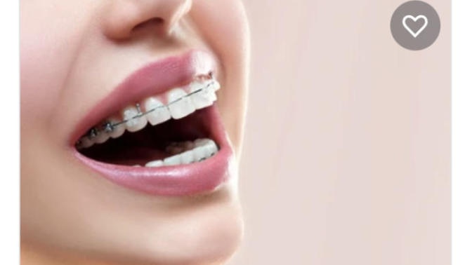 Are a lot of people self conscious about their teeth?