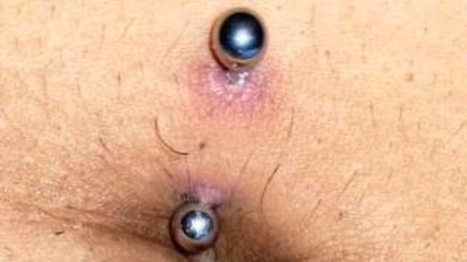 Is my belly button piercing infected?