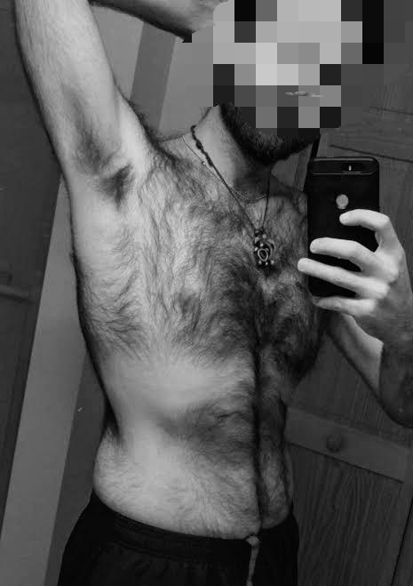 Girls, How do you feel about guys with overly hairy body?