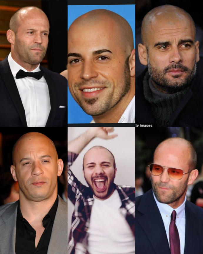 Do Bald Men Look Attractive To Women?
