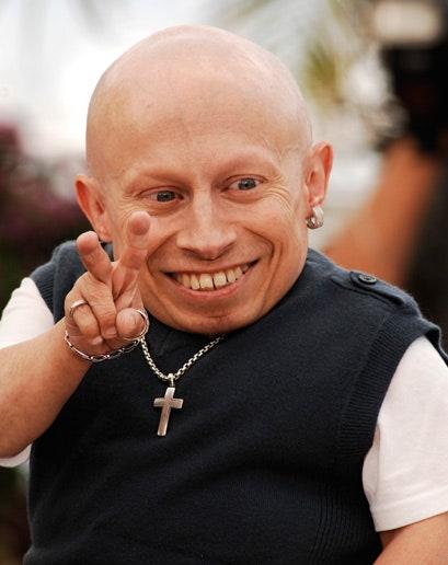 Do Bald Men Look Attractive To Women?