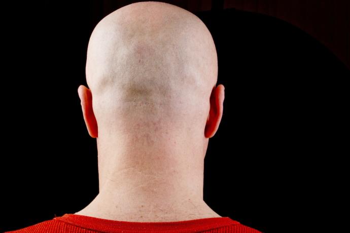 Do Bald Men Look Attractive To Women?