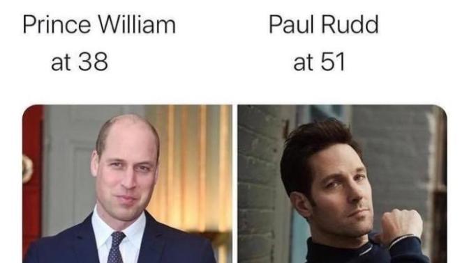 What makes some men age better than others? Also why do most men lose their hair?