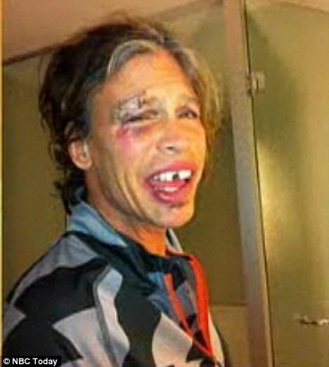 My cousins boyfriend Derrick said he would bash my moms teeth in, was he right to share his opinion ?
