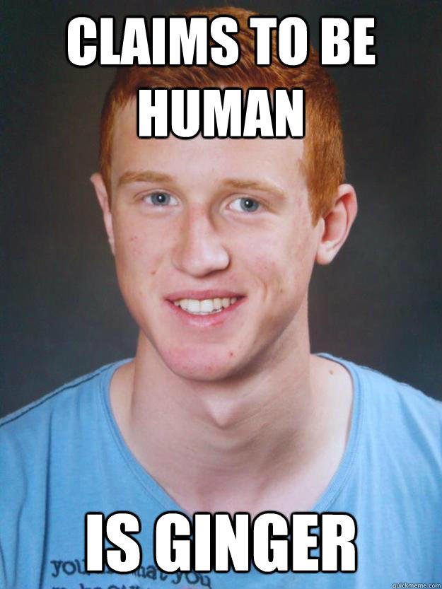 Everyone loves redhead girls, but nobody loves redhead guys. True or false?