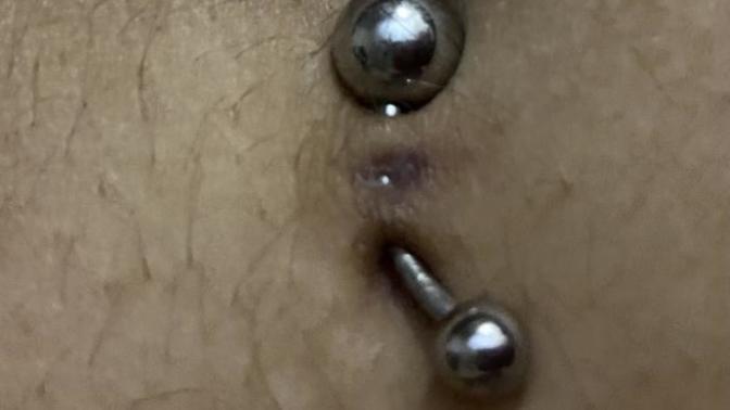 Why do I have a small whole in the middle of my belly piercing?