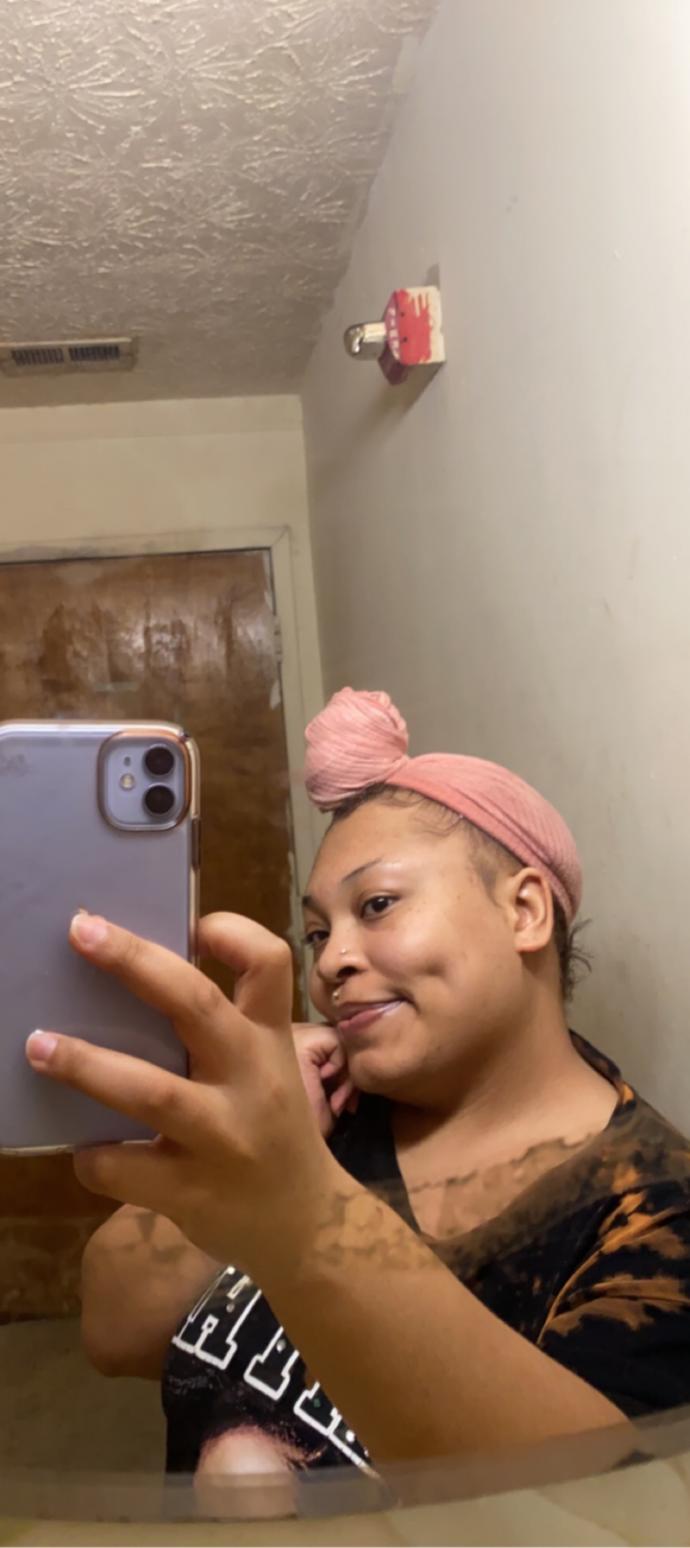 Are eyebags like this ugly or my acne?