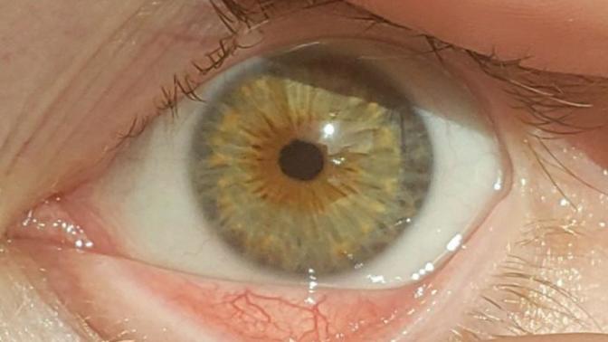How does an optometrist determine eye color?