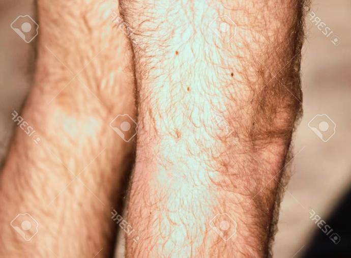 Girls, You prefer guys to shave / trim thighs & legs before wearing shorts?