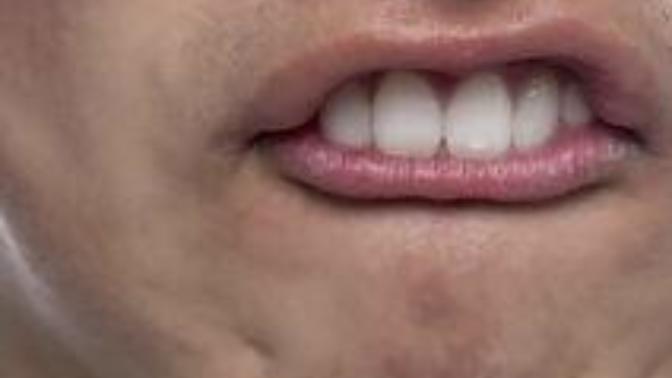 Serious question, why do gay guys have a lisp accent?