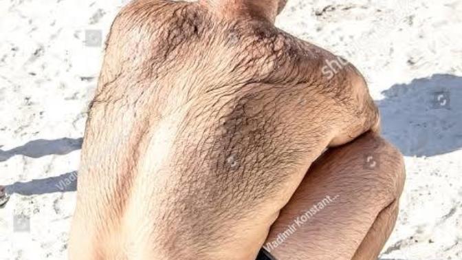 If you notice a guy having very hairy arms?