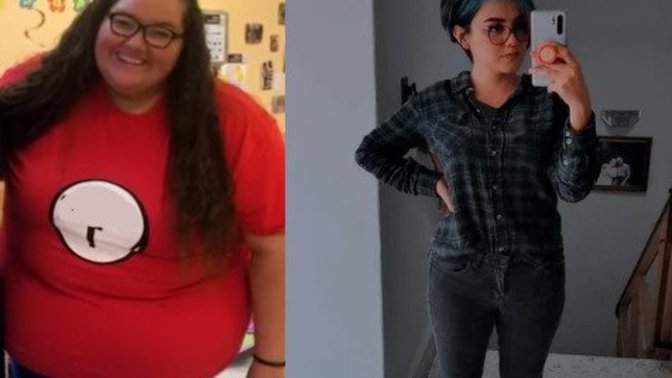 How do you feel after major weight loss?