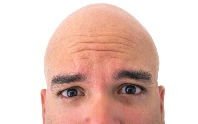 Do you like your partner hairy or bald?