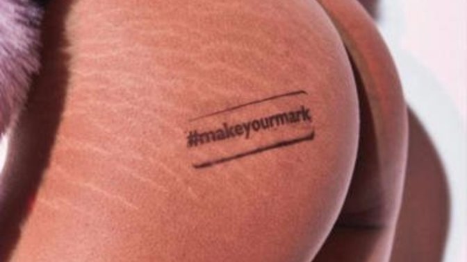 What do you think about the strech marks on hips? Would it be a turn off if you see it someone you like?