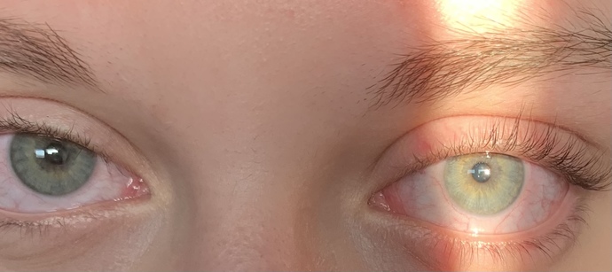 What Eye-Color should I put on my ID?