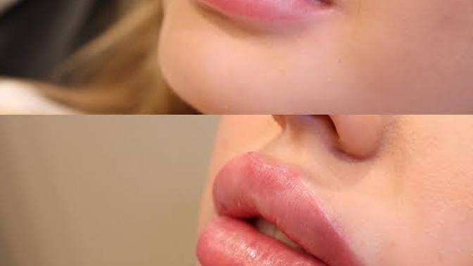 Does women who have aesthetic do not come to you very unattractive?