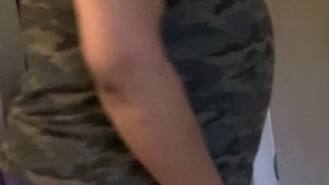 Why do I have a big pregnant looking stomach, it is hard and you can’t grab it?