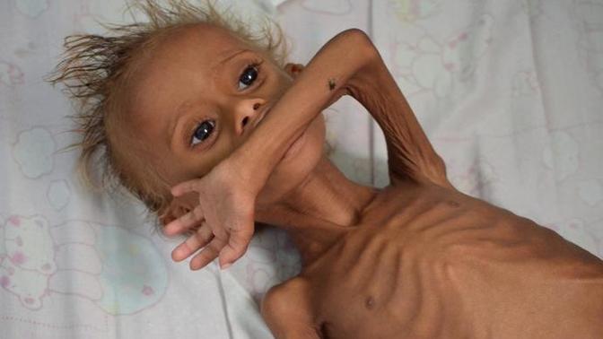 Why don't we let really needy people in instead of over fed South Americans?