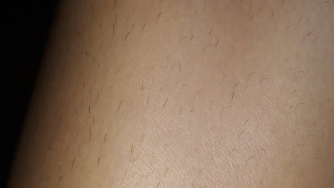 Guys, does this amount of leg hair bother you?