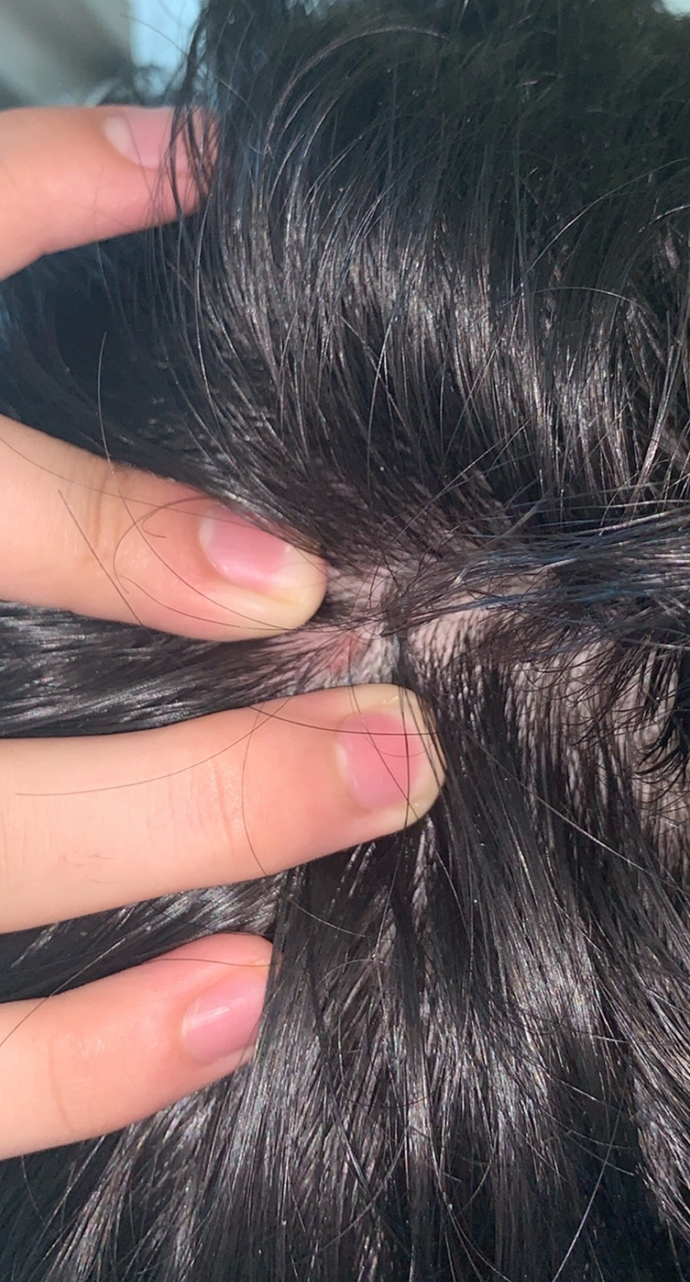 What is this spot on my scalp?