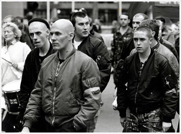 What Are The Characteristics Of Bald Men?