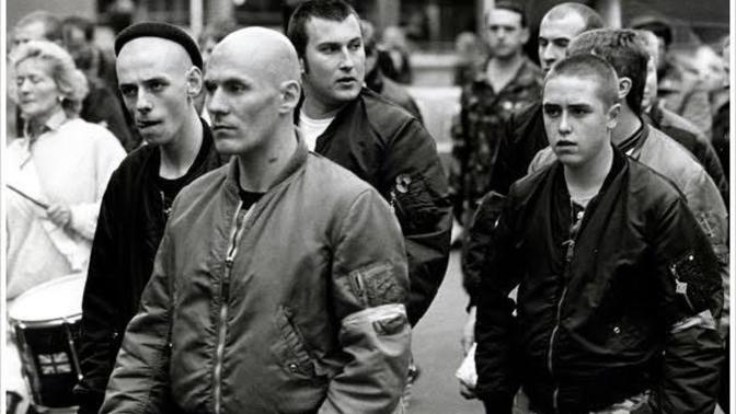 What Are The Characteristics Of Bald Men?