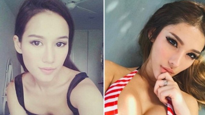Which picture of her is better looking the before plastic surgery (left) or the after plastic surgery (right)?