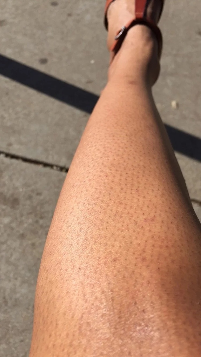 Do men find strawberry legs attractive?