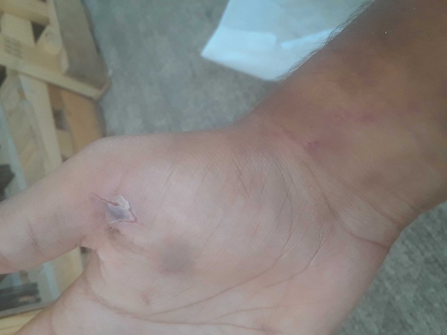 Does this look infected?