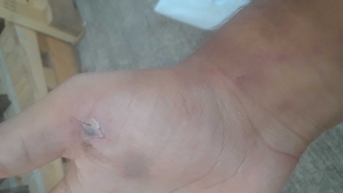 Does this look infected?