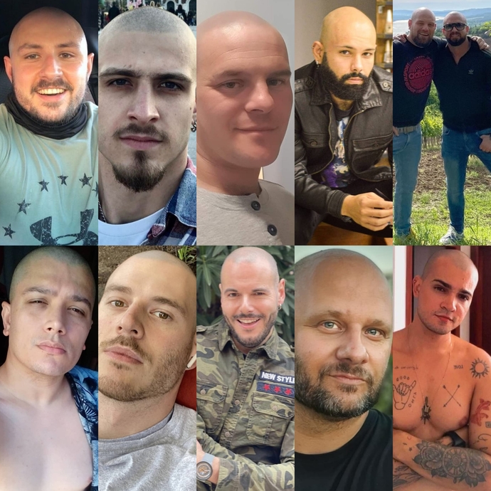 Are Bald Men Really Attractive?