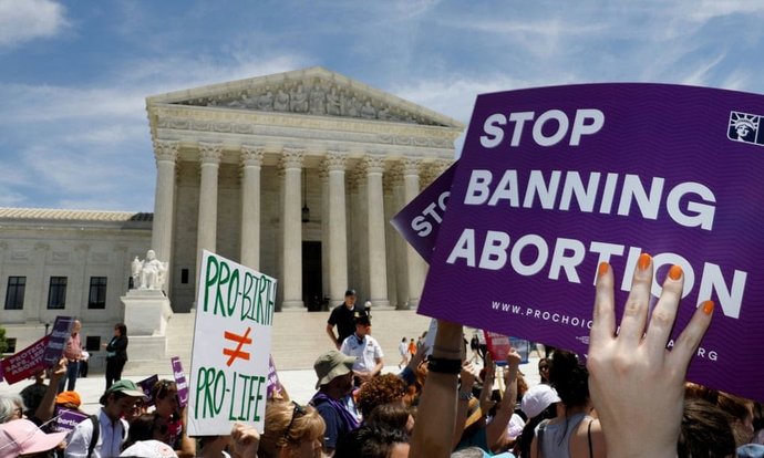 What is your opinion about the Anti-abortion Laws being forced through the supreme court?