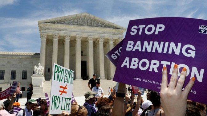 What is your opinion about the Anti-abortion Laws being forced through the supreme court?