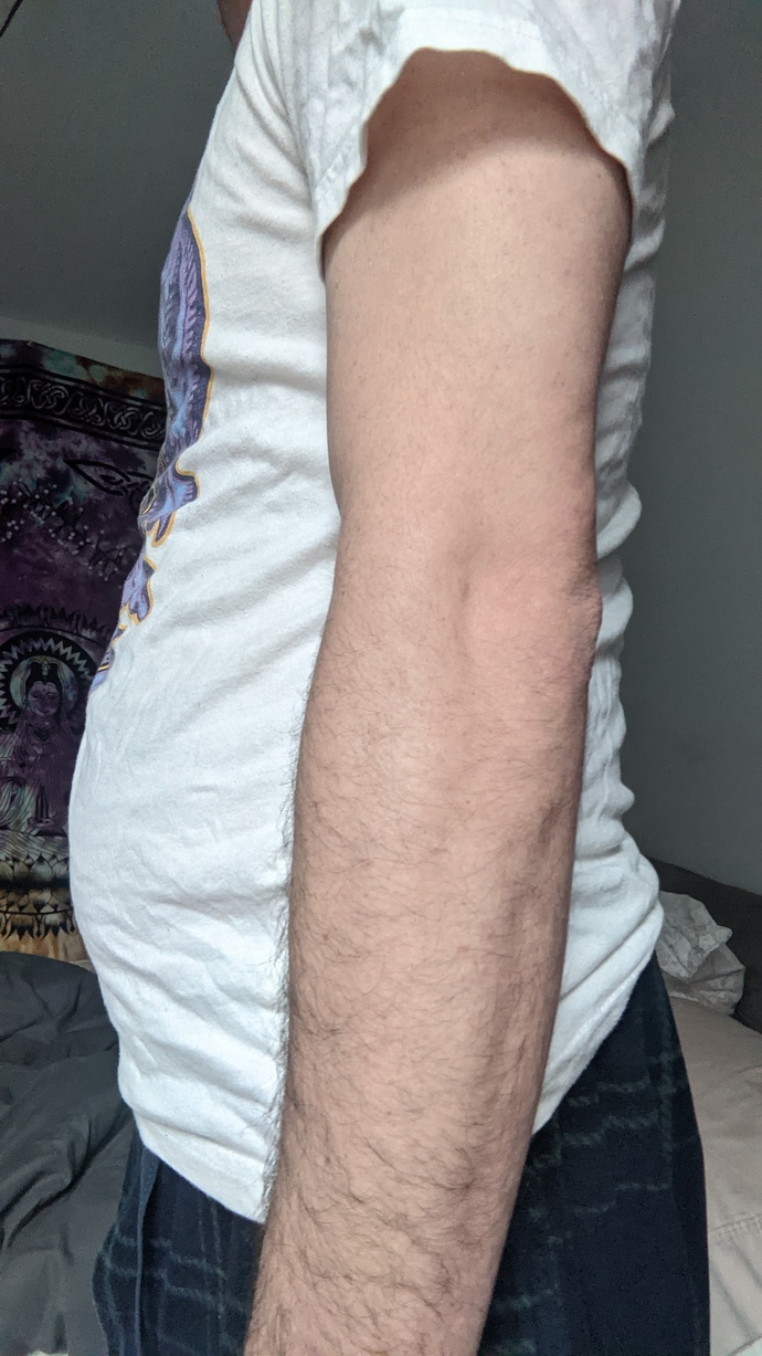 Girls, is being skinny fat like me worse than just being big and fat?