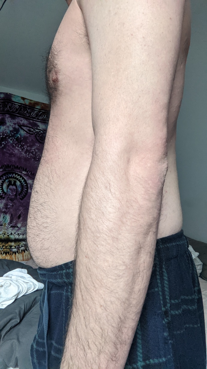 Girls, is being skinny fat like me worse than just being big and fat?
