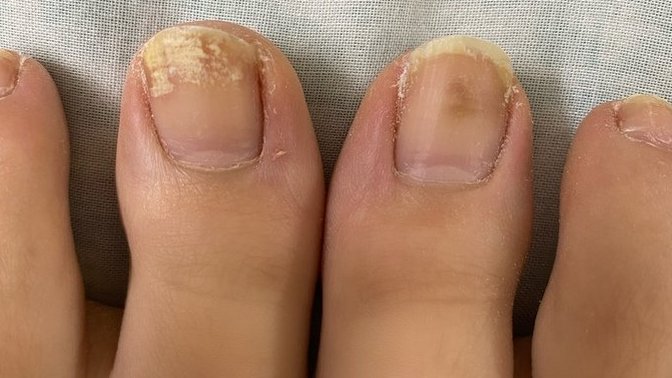 Should I see a doctor about this or is it normal?