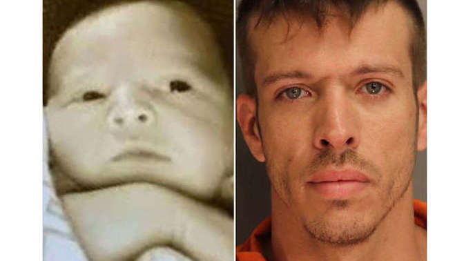 Would it have been better for this baby to have been aborted?