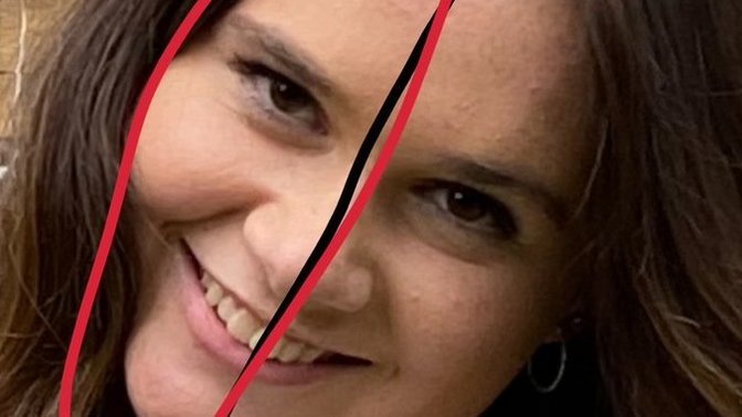 How can I improve this side of my face?