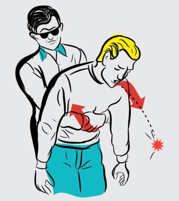 Have You Ever Given Someone The Heimlich Maneuver To Save Their Life?