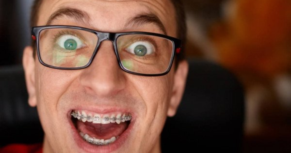 Girls, Do braces make a guy unattractive? Would you date a guy with