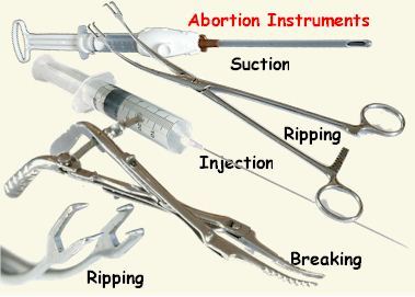 Is it wrong for a woman to have an abortion without telling the father of the baby that she's pregnant?