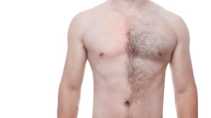 Do you wax chest hair or trim it?