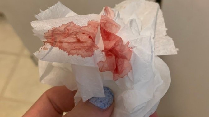 Girls, Period or Implanting?