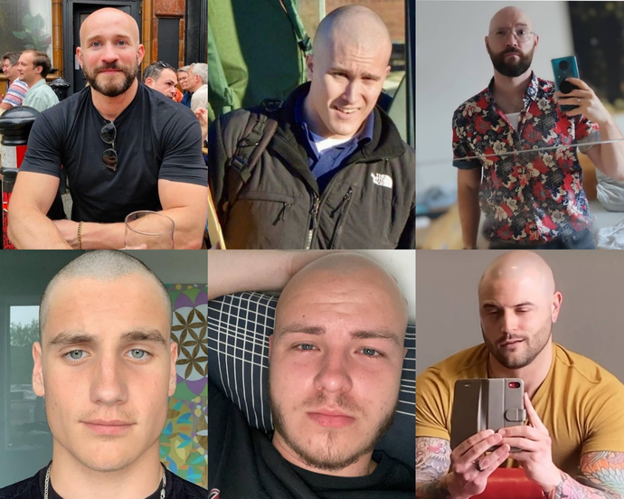 Do Bald Men Give A Bad Appearance?