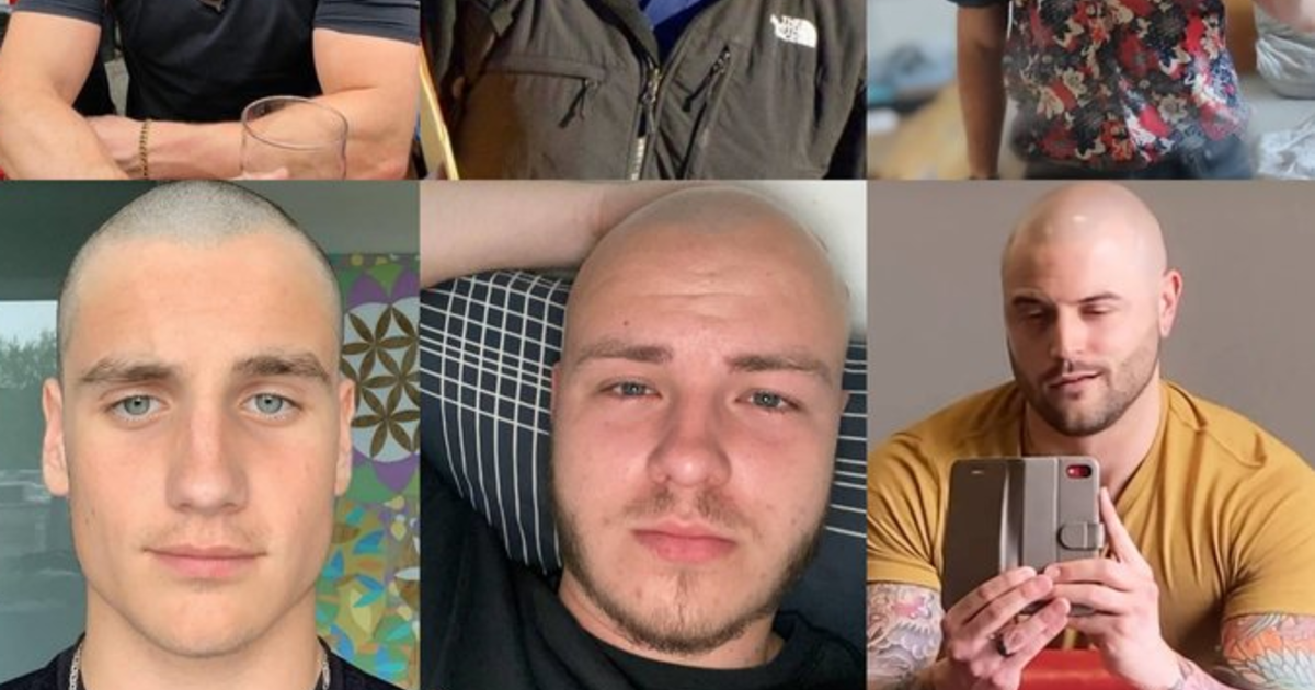 Do Bald Men Give A Bad Appearance? - GirlsAskGuys
