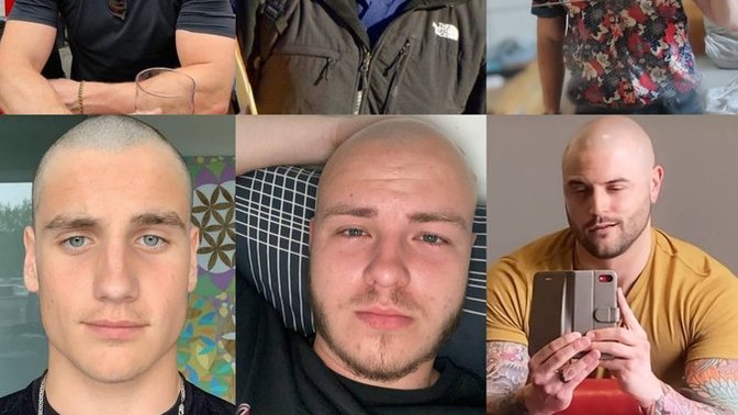 Do Bald Men Give A Bad Appearance?